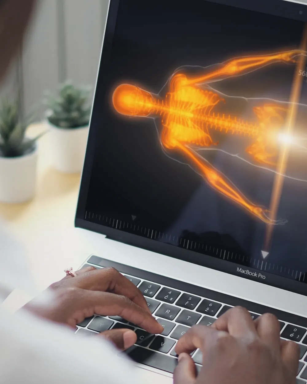 Profissional analisa em um computador o mapa corporal gerado pela avaliação